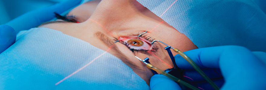 opération de la cataracte