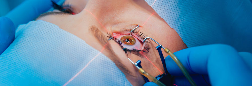 Chirurgie des yeux